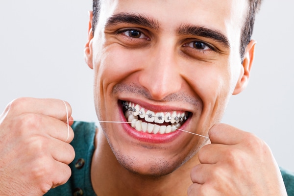 Orthodontic Treatment for Crooked Teeth