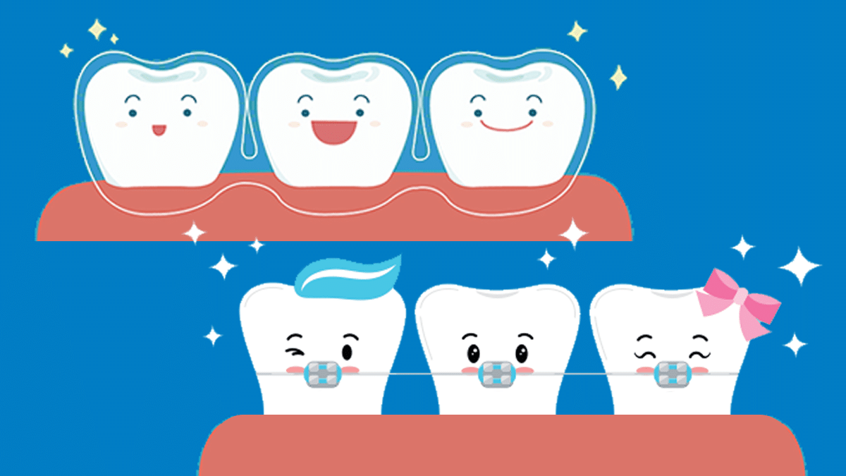What’s the Difference Between Invisalign and Braces?