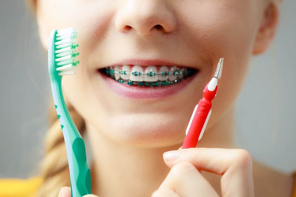 Do I Still Need to See a Dentist During Orthodontic Treatment?