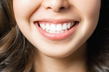 jaw surgery before and after
